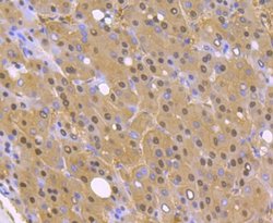 PSMA1 Rabbit anti-Human, Mouse, Rat, Clone: JU66-24, Novus Biologicals