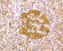 PSMA1 Rabbit anti-Human, Mouse, Rat, Clone: JU66-24, Novus Biologicals