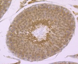 PSMA1 Rabbit anti-Human, Mouse, Rat, Clone: JU66-24, Novus Biologicals