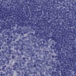 PSMB11 Antibody, Novus Biologicals 100 &mu;g; Unconjugated:Antibodies,