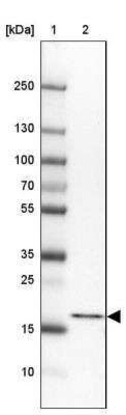 PSMB5 Antibody, Novus Biologicals 0.1 mL; Unconjugated:Antibodies, Polyclonal