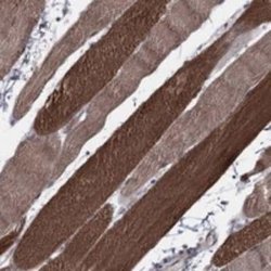 PSMC1 Rabbit anti-Human, Polyclonal, Novus Biologicals 100 &mu;g; Unconjugated:Antibodies,