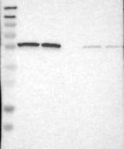 PSMC1 Rabbit anti-Human, Polyclonal, Novus Biologicals 100 &mu;g; Unconjugated:Antibodies,