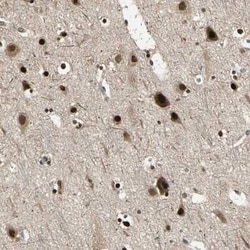 PSMC3 Antibody, Novus Biologicals 0.1 mL; Unconjugated:Antibodies, Polyclonal