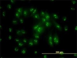 PSMC6 Antibody (2C4), Novus Biologicals 0.1 mg | Buy Online | Novus Biologicals | Fisher Scientific