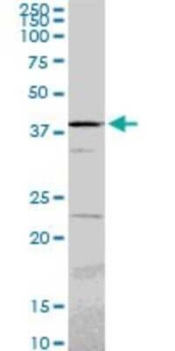 PSMC6 Antibody (2C4), Novus Biologicals 0.1 mg | Buy Online | Novus Biologicals | Fisher Scientific