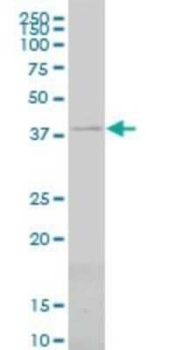 PSMC6 Antibody (2C4), Novus Biologicals 0.1 mg | Buy Online | Novus Biologicals | Fisher Scientific