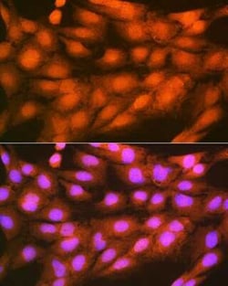 PSMD14 Rabbit anti-Human, Mouse, Rat, Clone: 5V0H3, Novus Biologicals 100 &mu;g | Buy Online | Novus Biologicals | Fisher Scientific