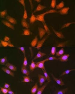 PSMD14 Rabbit anti-Human, Mouse, Rat, Clone: 5V0H3, Novus Biologicals 100 &mu;g | Buy Online | Novus Biologicals | Fisher Scientific