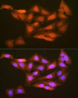 PSMD14 Rabbit anti-Human, Mouse, Rat, Clone: 5V0H3, Novus Biologicals 100 &mu;g | Buy Online | Novus Biologicals | Fisher Scientific