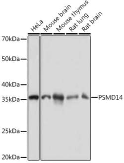 PSMD14 Rabbit anti-Human, Mouse, Rat, Clone: 5V0H3, Novus Biologicals 100 &mu;g | Buy Online | Novus Biologicals | Fisher Scientific