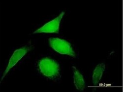 PSMD14 Antibody, Novus Biologicals 0.05 mg | Buy Online | Novus Biologicals | Fisher Scientific