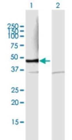 PSMD6 Antibody, Novus Biologicals 0.05 mg | Buy Online | Novus Biologicals | Fisher Scientific