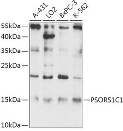 PSORS1C1 Antibody - Azide and BSA Free, Novus Biologicals 20 &mu;g; Unconjugated:Antibodies,