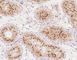 PSPC1 Antibody, Novus Biologicals 100 &mu;g; Unconjugated:Antibodies, Polyclonal