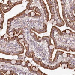 PSTK Antibody, Novus Biologicals 25 &mu;L, Unconjugated:Antibodies, Polyclonal