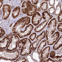 PSTK Antibody, Novus Biologicals 25 &mu;L, Unconjugated:Antibodies, Polyclonal