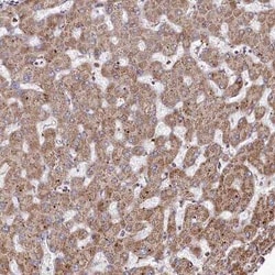 PSTK Antibody, Novus Biologicals 25 &mu;L, Unconjugated:Antibodies, Polyclonal