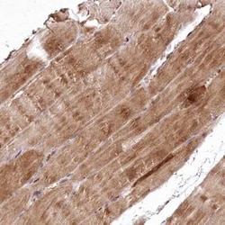 PSTK Antibody, Novus Biologicals 25 &mu;L, Unconjugated:Antibodies, Polyclonal