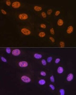 PTBP2 Rabbit anti-Human, Mouse, Rat, Clone: 10S9P6, Novus Biologicals:Antibodies:Primary