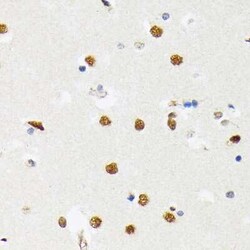 PTBP2 Rabbit anti-Human, Mouse, Rat, Clone: 10S9P6, Novus Biologicals:Antibodies:Primary