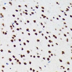 PTBP2 Rabbit anti-Human, Mouse, Rat, Clone: 10S9P6, Novus Biologicals:Antibodies:Primary
