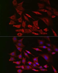 PTEN Rabbit anti-Human, Mouse, Rat, Clone: 7O6F4, Novus Biologicals 100