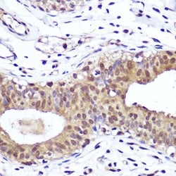 PTEN Rabbit anti-Human, Mouse, Rat, Clone: 7O6F4, Novus Biologicals 100