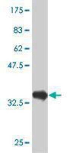 PTF1A Antibody (1B8), Novus Biologicals 0.1 mg | Buy Online | Novus Biologicals | Fisher Scientific