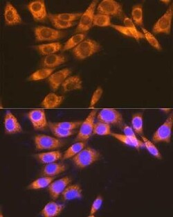 PTGER2 Rabbit anti-Human, Mouse, Rat, Clone: 2G10L6, Novus Biologicals 20 &mu;g | Buy Online | Novus Biologicals | Fisher Scientific