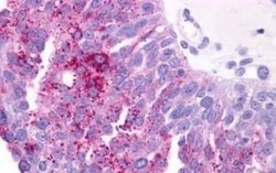 PTGER3 Antibody, Novus Biologicals 50 &mu;g | Buy Online | Novus Biologicals | Fisher Scientific