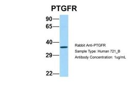 PTGFR Rabbit anti-Human, Polyclonal, Novus Biologicals 0.1 mL | Buy Online | Novus Biologicals | Fisher Scientific