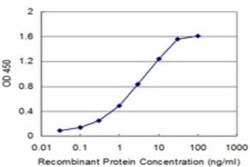 Novus Biologicals PTGIR Antibody (2A7), Novus Biologicals 0.1 mg | Buy Online | Novus Biologicals&trade; | Fisher Scientific