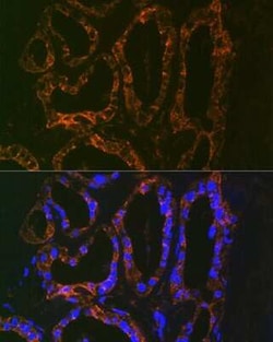 PTH Rabbit anti-Human, Mouse, Rat, Clone: 5X6R6, Novus Biologicals 20 &mu;g;
