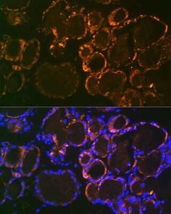 PTH Rabbit anti-Human, Mouse, Rat, Clone: 5X6R6, Novus Biologicals 20 &mu;g;