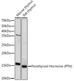 PTH Rabbit anti-Human, Mouse, Rat, Clone: 5X6R6, Novus Biologicals 20 &mu;g;