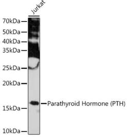 PTH Rabbit anti-Human, Mouse, Rat, Clone: 5X6R6, Novus Biologicals 20 &mu;g;