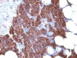PTH Antibody (3H9 + PTH/1175) - C-terminus, N-terminal, Novus Biologicals:Antibodies:Primary