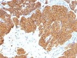 PTH Antibody (3H9) - N-terminal, Novus Biologicals:Antibodies:Primary Antibodies