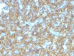 PTH Antibody (PTH/1174) - C-terminus, Novus Biologicals 0.1mg; Unlabeled:Antibodies,
