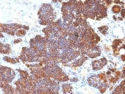 PTH Antibody (PTH/1174) - C-terminus, Novus Biologicals 0.1mg; Unlabeled:Antibodies,