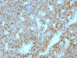 PTH Antibody (PTH/1175) - C-terminus, R&D Systems&trade;