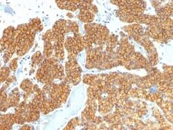 PTH Antibody (PTH/911) - N-terminal, Novus Biologicals:Antibodies:Primary