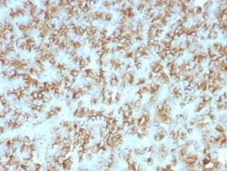 PTH Antibody (PTH/911) - N-terminal, Novus Biologicals:Antibodies:Primary