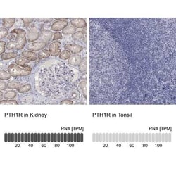 PTH1R/PTHR1 Rabbit anti-Human, Polyclonal, Novus Biologicals 25 &mu;g;