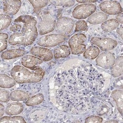 PTH1R/PTHR1 Rabbit anti-Human, Polyclonal, Novus Biologicals 25 &mu;g;