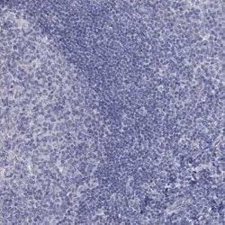 PTH1R/PTHR1 Rabbit anti-Human, Polyclonal, Novus Biologicals 25 &mu;g;