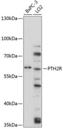 PTH2R Antibody - BSA Free, Novus Biologicals 0.02 mL; Unconjugated:Antibodies,