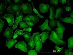 PTK7/CCK4 Antibody (4F5), Novus Biologicals 0.1 mg | Buy Online | Novus Biologicals | Fisher Scientific