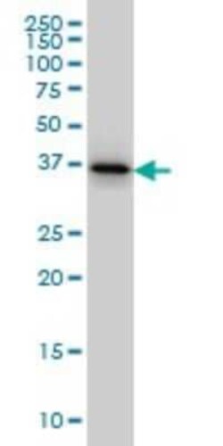 Novus Biologicals PTK9 Antibody (1E2), Novus Biologicals 0.1 mg | Buy Online | Novus Biologicals&trade; | Fisher Scientific
